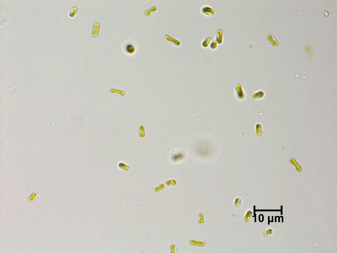 Stichococcus bacillaris (Code - 7A1SS)